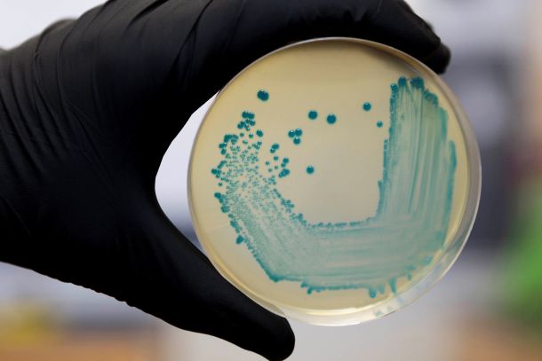 images/bulletin/7104/listeria.jpg